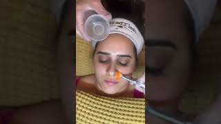 Cellstory Liquid microneedling [upl. by Jarrod]