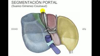 Segmentacion hepática [upl. by Eenyaj]