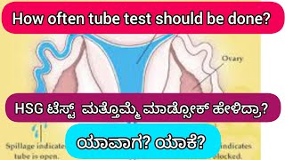 Do we need to repeat HSG test testing pregnancy pregnant baby kannada infertilitytipshealth [upl. by Lassiter443]