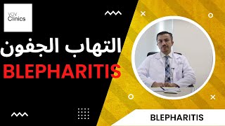 Blepharitis  التهاب جفون العين [upl. by Aeslehs]