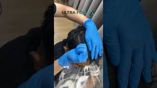 Achieve Full Hair in Just 5 Months [upl. by Oivatco]