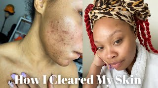 Skincare Routine For Hyperpigmentation amp Dark Spots  CeraVe [upl. by Viv]