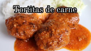 DELICIOSAS Y JUGOSITAS TORTITAS DE CARNE [upl. by Kussell635]