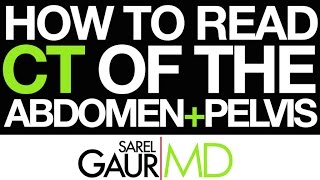 How to read CT of the Abdomen and Pelvis [upl. by Racklin5]