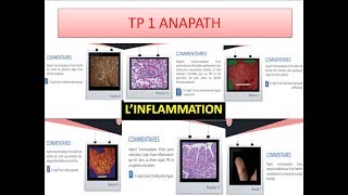 réussir son examen danapath tp n°1 linflammation [upl. by Ennalyrehc416]