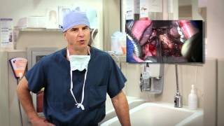 Transoral Surgery for Head and Neck Cancer  Mayo Clinic [upl. by Iaoh]