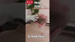 Riesige Zyste  Dr Pimple Popper  shorts  TLC Deutschland [upl. by Okiman238]