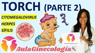 TORCH PARTE 2 CITOMEGALOVIRUS HERPES SÍFILIS Infecciones y embarazo Ginecología y Obstetricia [upl. by Carling]