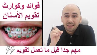 تقويم الأسنان سلاح ذو حدين لو هتعمل تقويم؟ ده أهم فيديو لااازم تشوفه [upl. by Jago]