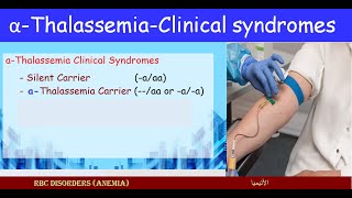 Lecture 251 Carriers alfa Thalassemia  Clinical Syndromes [upl. by Scever]