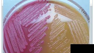 Pseudomonas spp and Acinetobacter spp [upl. by Assitruc]