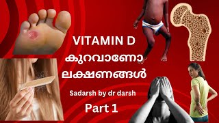 VitaminD deficiency Malayalam  less vitamind vitamind hairfallbody pain [upl. by Isiah557]