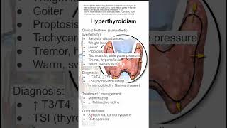 Hyperthyroidism [upl. by Eisenhart]