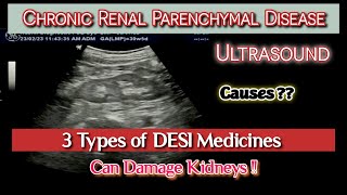 Chronic Renal Parenchymal Disease CKD  Effects of Desi Medicines  Causes  Ultrasound [upl. by Bianchi131]