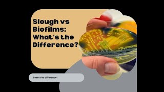 Slough vs Biofilms A clear Distinction [upl. by Ennairb]