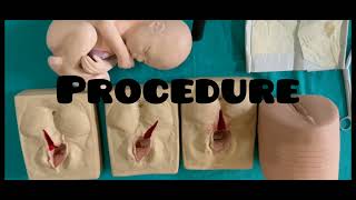 Episiotomy and PeriniotomyOBG [upl. by Atikaj148]