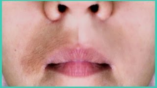 ELIMINA Y ACLARA EL BIGOTE EN 5 MINUTOS NATURALMENTE  Te encantará [upl. by Ennavoj]