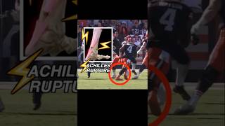 Doctor explains Deshaun Watson Achilles injury in 60 seconds browns nflnews anatomy medical [upl. by Erdne139]