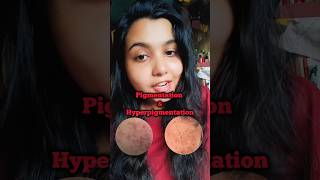 How to Remove Pigmentation Permanently shorts [upl. by Romilly]