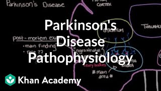 Putting it all together  Pathophysiology of Parkinsons disease  NCLEXRN  Khan Academy [upl. by Olivette]