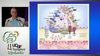 Recurrent FSGS What’s New  UCSF Kidney Transplant Program  Update in Transplantation 2013 [upl. by Cannon45]