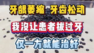 牙龈萎缩、牙齿松动，我没让患者拔过牙，仅一方就能治好 [upl. by Iridissa]