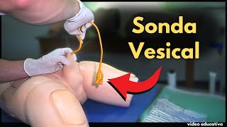 Colocación de Sonda Vesical en Hombres y Mujeres Guía Completa [upl. by Pirozzo]