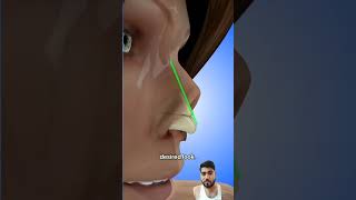 piercing beauty skincare satisfying nose nosejobs rhinoplastycost plasticsurgery rhinoplast [upl. by Darlleen]