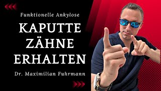 Stark zerstörte Zähne erhalten Wie Mit funktioneller Ankylose  Zahnarzt Dr Maximilian Fuhrmann [upl. by Wendelin]