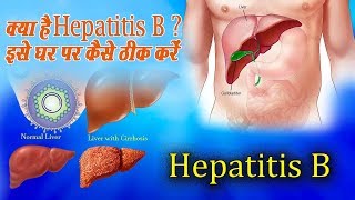 Hepatitis B को ठीक करने के घरेलू नुस्खे  Hepatitis B ke gharelu nuskhe  Health Vatika [upl. by Eriam]