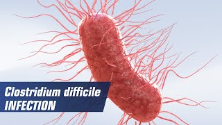 Clostridium difficile infection [upl. by Lisbeth]