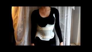 Skoliose mein NEUES Korsett aus der Kur  my new back brace [upl. by Ahc]