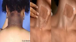 Neck Cleaning Tips Dark Neck Home RemediesTanning Removal Tips 😱beautyskincareviral [upl. by Aylmer46]