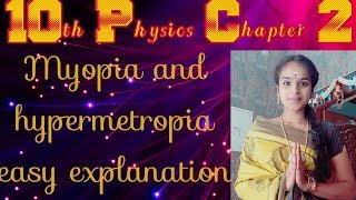 Myopia and Hypermetropia easy explanation [upl. by Eeliak712]