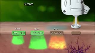 Lutronic DermaV 醫學級血管激光  治療原理及儀器簡介 [upl. by Nuhsed]