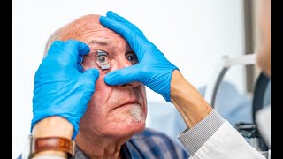 VA disability ratings for Eye Conditions [upl. by Fedora]