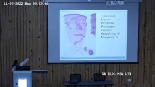 Pathology and Pathogenesis of Leprosy Dr Priyanka Agarwal [upl. by Consuelo]