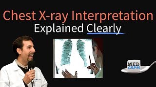 Chest XRay Interpretation Explained Clearly  How to read a CXR [upl. by Lavoie193]