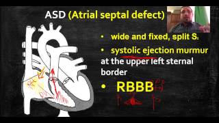 شرح وحل مجموعة من اسئلة الكروك Cardiology [upl. by Ynohtnaleahcim]