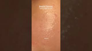 cleanser rosehip skincare cloggedpores sensitiveskin kbeauty fyp explore foryou [upl. by Trey]