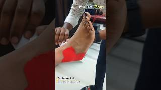 Ankle Sprain Taping  Ankle Stability  Sprained Ankle [upl. by Koblick]