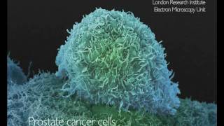 What Does Cancer Look Like  Cancer Research UK [upl. by Cohlier]