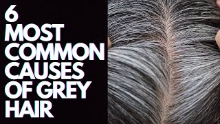 6 Most Common Causes Of Grey Hair [upl. by Gardiner]