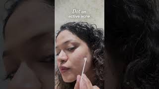 Overnight Acne Spot Corrector  How to Use [upl. by Nolla152]