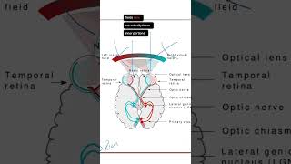 Bitemporal Hemianopia Explained neuroanatomy [upl. by Hajin119]