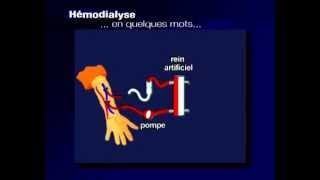 comment ça marche lhémodialyse [upl. by Sseb220]