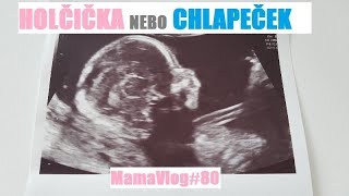 MamaVlog80  Holka nebo kluk  Máma v Německu [upl. by Favian]