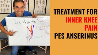 How To Cure Inner Knee Pain Caused By Pes Anserine Bursitis Easy Self Treatment That Works [upl. by Itirp]