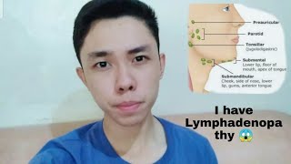 I HAVE LYMPHADENOPATHY 😱  MICHAEL LANUZA VLOGS [upl. by Amlev]