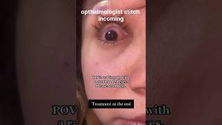 Viral Conjunctivitis Explained Causes Symptoms amp Solutions by Dr Shakil Ahmad [upl. by Obeng8]